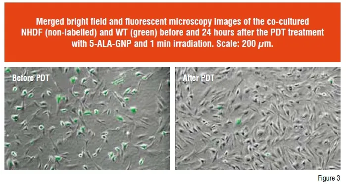 Merged bright field and fluorescent microscopy images
