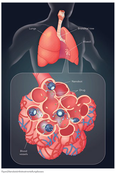  diseased lung tissues