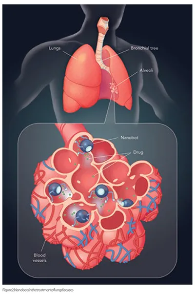 diseased lung tissues