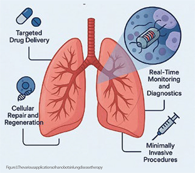 nanobots in lung disease management