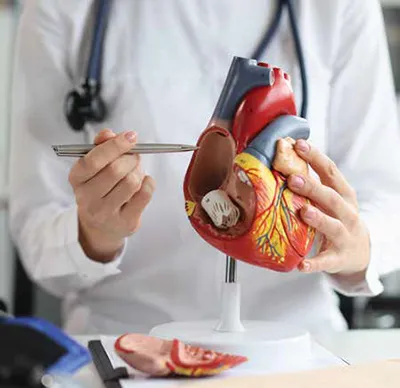 Cardiovascular diseases