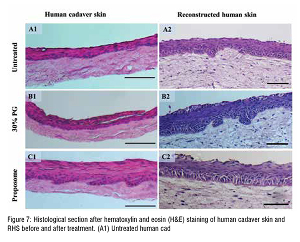 Hestological section after hematoxylin and eosin