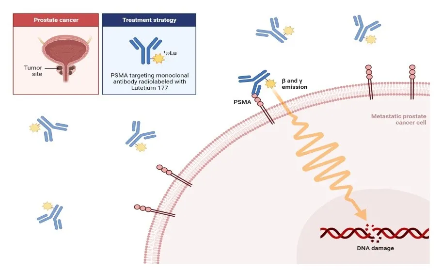 Radiolabeling for Prostate Cancer targeting