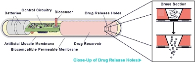 ChipRX Self Regulating Respective Therapeutic System 